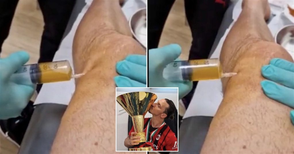 Zlatan Ibrahimović publica vídeo gráfico do seu joelho a ser drenado thumb5 3